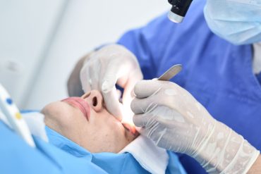 Korekcja plastyczna podwiniętej powieki dolnej.