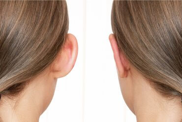 Operacja plastyczna uszu