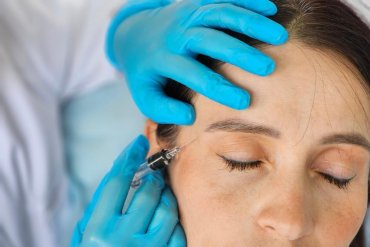 Zabieg uniesienia Łuków bojowych u kobiety